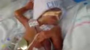 Недоношенный малыш в кювезе (любительское видео)