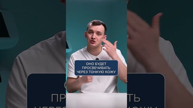 Как убрать синяки под глазами НАВСЕГДА?