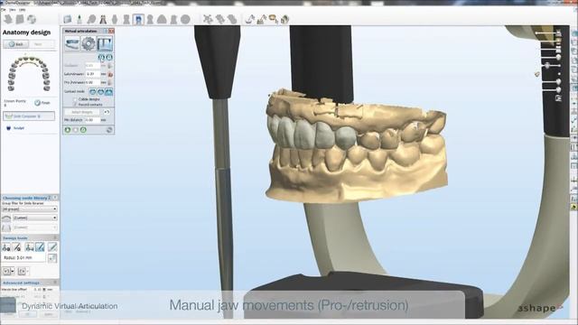 Esempio virtual articulator