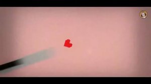 песня санса уровень резни