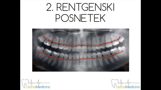Sodobna diagnostika parodontalne bolezni смотреть онлайн