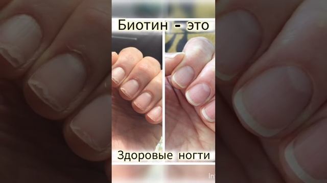 витамин красоты #бадыдляздоровья #сибирскоездоровье
