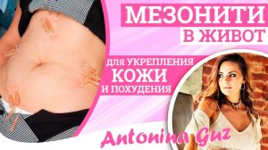 Мезонити в живот для укрепления кожи и похудения