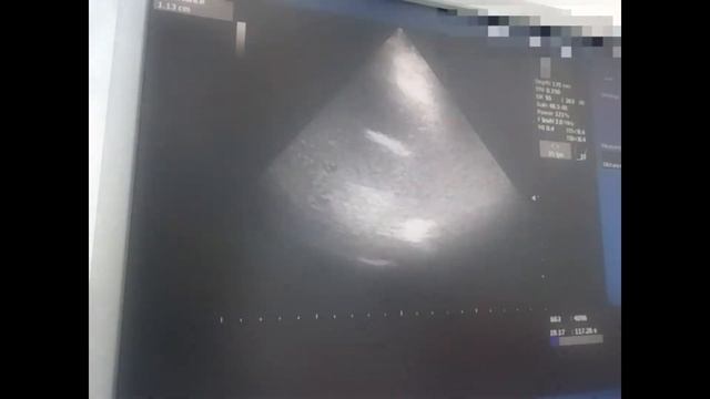 Очередной передний смотреть онлайн