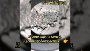 Удаление катализатора Kia Киа