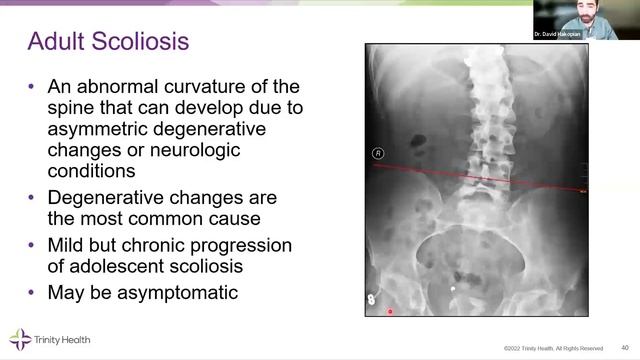 Back to Basics: The Typical Aging Spine and Care Strategies | Wednesday Wellness смотреть онлайн