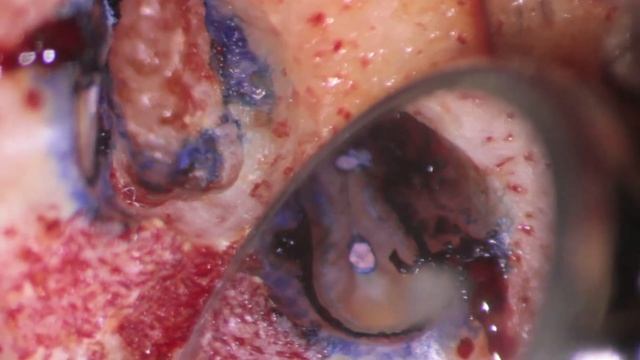 CHANIOTIS SURGICAL TRAINING VIDEOS смотреть онлайн