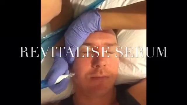 Mesotherapy advanced Facial Meso therapy needling collagen stimulation