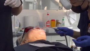 Протезирование по технологиии all on 6. Верхняя челюсть