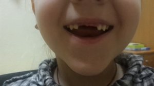 Логопед. Как получить чистый звук Р от упражнения" Ветерок"? Занятие 14