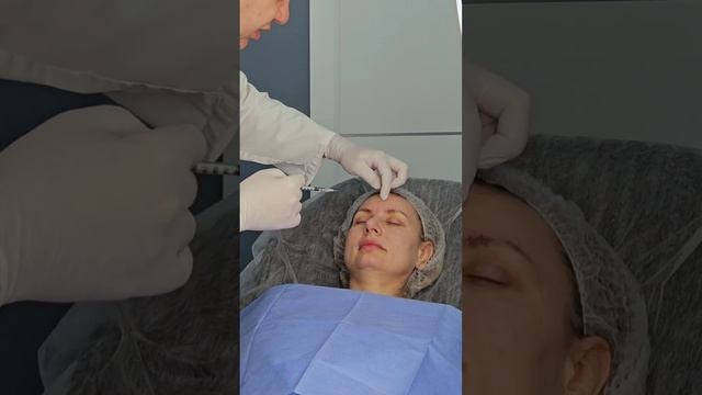 Как корректировать мимические морщины лба ботулотоксином?