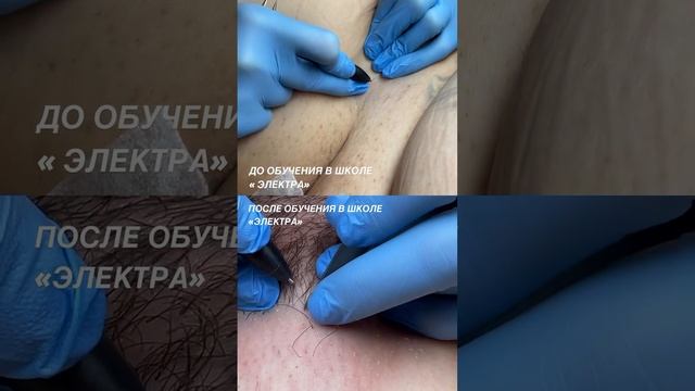 Школа обучения электроэпиляции "Электра"