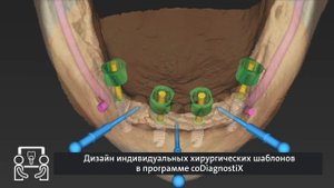 А вы уже перешли на цифровой протокол Straumann?