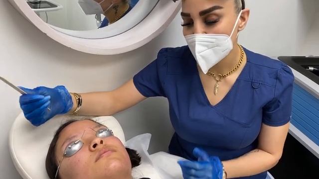 PicoSure laser melasma removal and scar removal