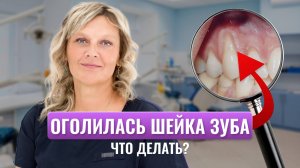 Оголение шейки зуба: лечение, причины, профилактика | Клиновидные дефекты – как избежать рецидива?