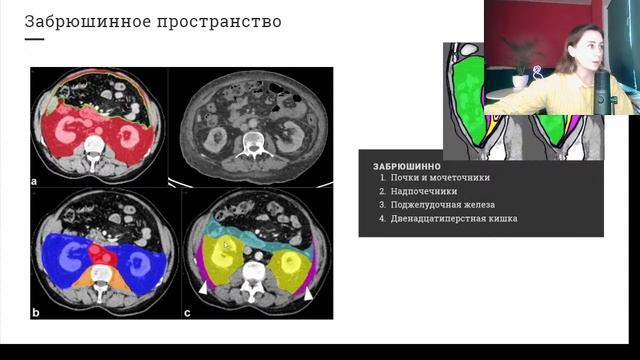 Вебинар: «КТ и МРТ брюшной полости и забрюшинного пространства» для начинающих.