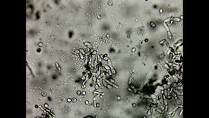 Симбиоз архебактерий  и дрожжей