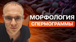 Морфология спермограммы. Тератозооспермия. Врач уролог-андролог. Москва.