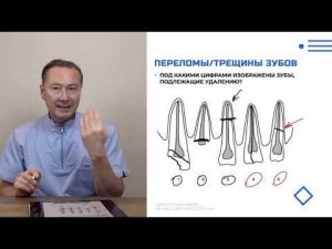 Модуль 1 Урок 3 Показания и противопоказания к удалению зубов