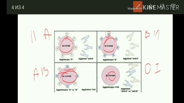 Qan qrupları .Qanköçürmə смотреть онлайн
