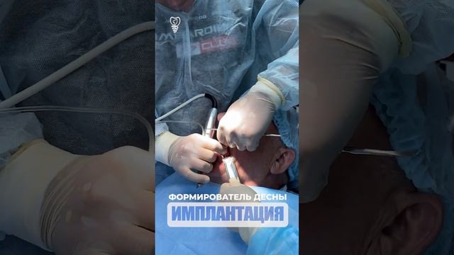 Формирователь десны. Имплантация. Implantation.