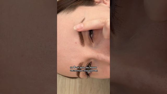 Как заживает татуаж. Корочки после татуажа бровей.