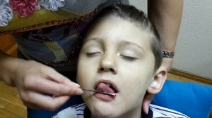 Логопедический массаж губ и языка для не говорящих детей. Как делать в домашних условиях?