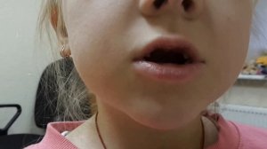 Как поставить звук Ч правильно? Проверенный и быстрый способ при дизартрии