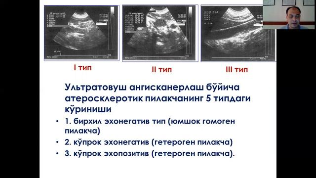 Аорта равоғи касалликлари смотреть онлайн