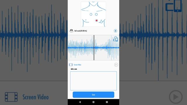 Male heartbeat using stemoscope - headphones recommended