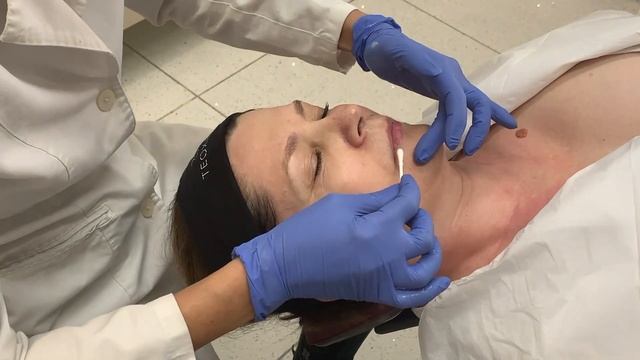 Obagi Blue Peel radiance смотреть онлайн