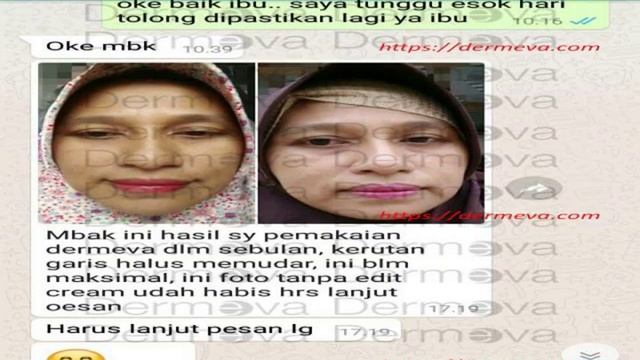 WA 0813 5979 0983 REKOMENDASI SERUM KULIT KERING ANTI AGING CREAM DERMEVA TERBAIK смотреть онлайн