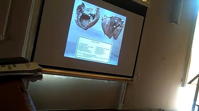 Анатомия сердца, лекция смотреть онлайн