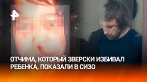 Изуродовал 12-летнего: отчим зверски издевался над мальчиком – его арестовали в Прокопьевске