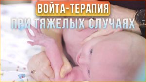 Помогает ли Войта-терапия тяжелым пациентам?