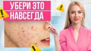 Как убрать темные пятна и рубцы от акне? Этот способ РАБОТАЕТ!