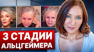 ТРИ СТАДИИ БОЛЕЗНИ АЛЬЦГЕЙМЕРА И ПЕРВЫЕ СИМПТОМЫ - ДОЛЖЕН ЗНАТЬ КАЖДЫЙ!