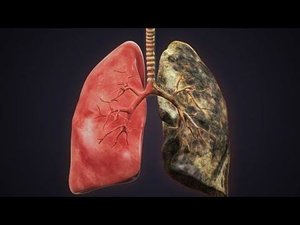 чистка лёгких в домашних условиях! секрет натуральный рецепт