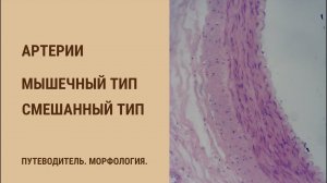 Артерии. Мышечный тип. Смешанный тип