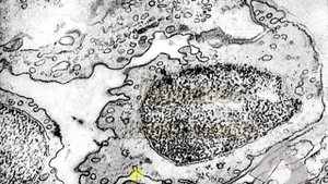 ПИНОЦИТОЗ (электронограмма)