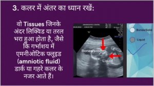 Ultrasound Picture Explained | Ultrasound Report In Hindi - Sonography Pictures