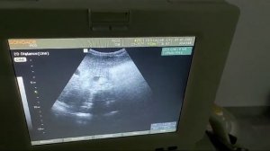Анатомия от Стивена. УЗИ брюшной полости: сегменты и размеры брюшной полости.