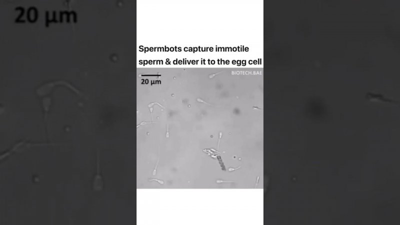 These spermbots capture immotile sperm & deliver it to the egg cell (oocyte) invitro..