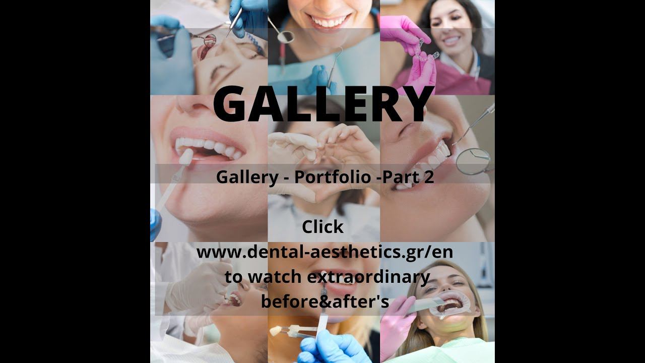 Gallery 2 -Dental Aesthetics Athens смотреть онлайн
