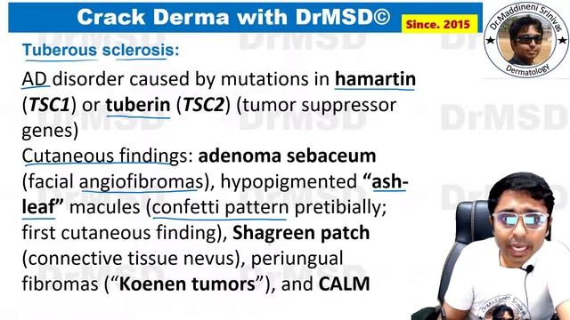 Tuberous sclerosis | Vogts Triad | EpiLoiA | Adenoma sebaceum | Koenens tumours | Ash Leaf Macules