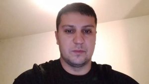 надо ли удалять зубы мудрости?)