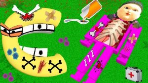 КУКЛА ИЗ ИГРЫ КАЛЬМАРА И АЛФАВИТ ЛОР ЗАБОЛЕЛИ И ИМ СРОЧНО ТРЕБУЕТСЯ ОПЕРАЦИЯ В МАЙНКРАФТ