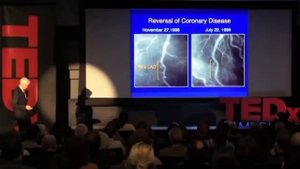 ПРОДУКТЫ ДЛЯ ЛЕЧЕНИЯ СЕРДЦА,ЛЕКЦИЯ ИЗВЕСТНЕЙШЕГО  ХИРУРГ КОЛДУЭЛЛА ЭССЕЛЬСТИНА.