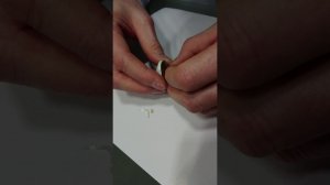 Remove Medtronic Guardian™ 2 battery