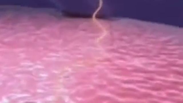 HIV Viral Replication смотреть онлайн